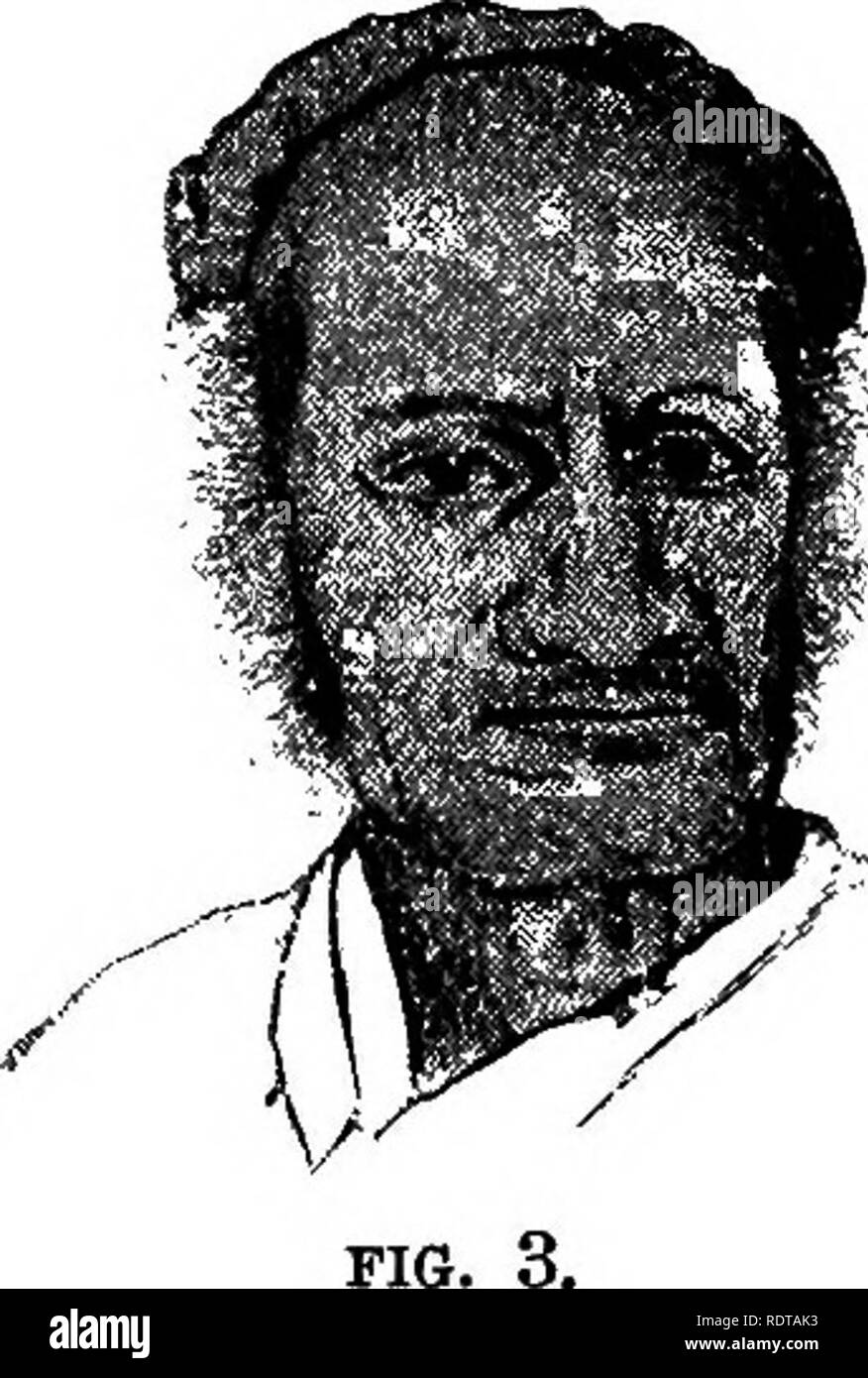 A Naturalist S Wanderings In The Eastern Archipelago A Narrative Of Travel And Exploration From 1878 To 1883 Natural History 466 A Naturalist S Wanderings With Light Brown Patches The Hair Is Straight