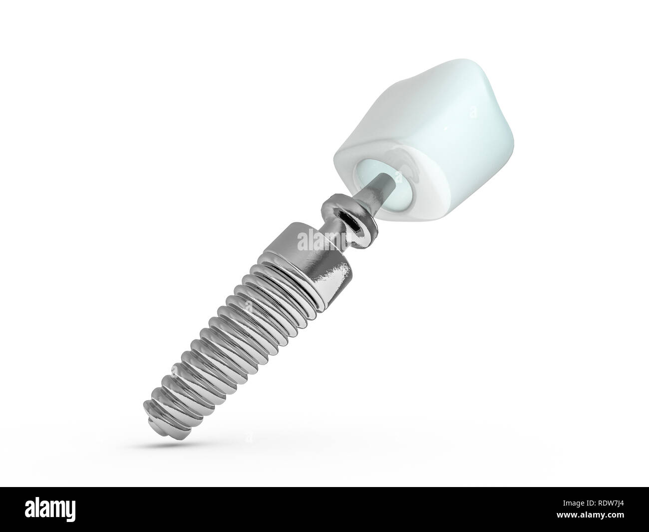 Dental implant dentist, tooth layout, plastics, man, teeth treatment 3D rendering Stock Photo