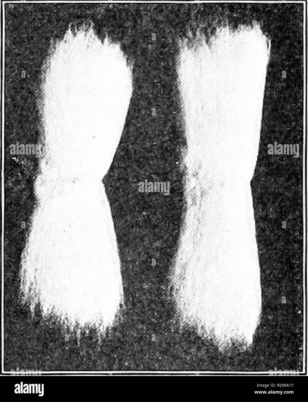 Bast fiber threads Black and White Stock Photos & Images Alamy