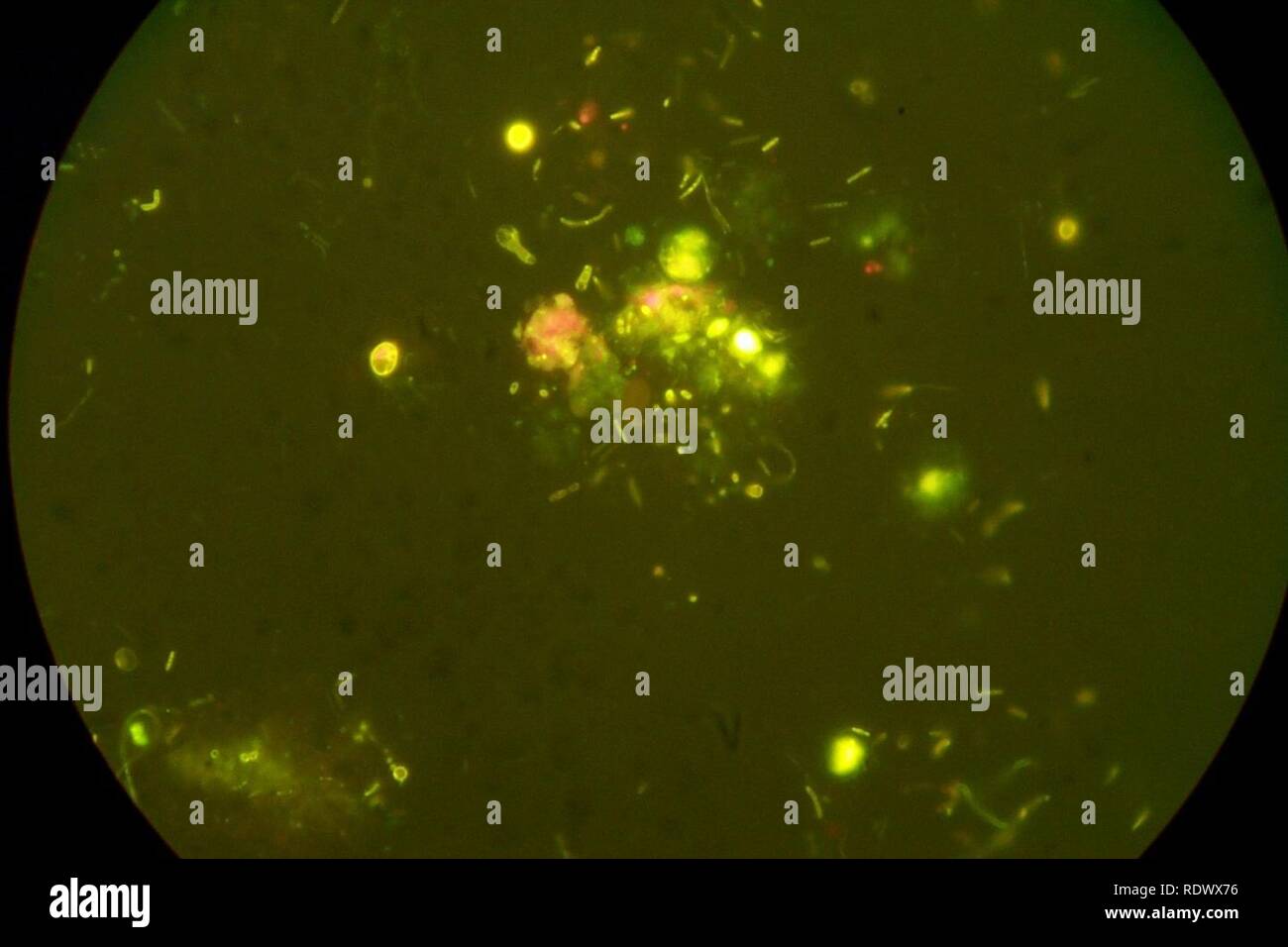 Aquatic Bacteria Samples 4817491971 Stock Photo Alamy aquatic-bacteria-samples-4817491971-stock-photo-alamy