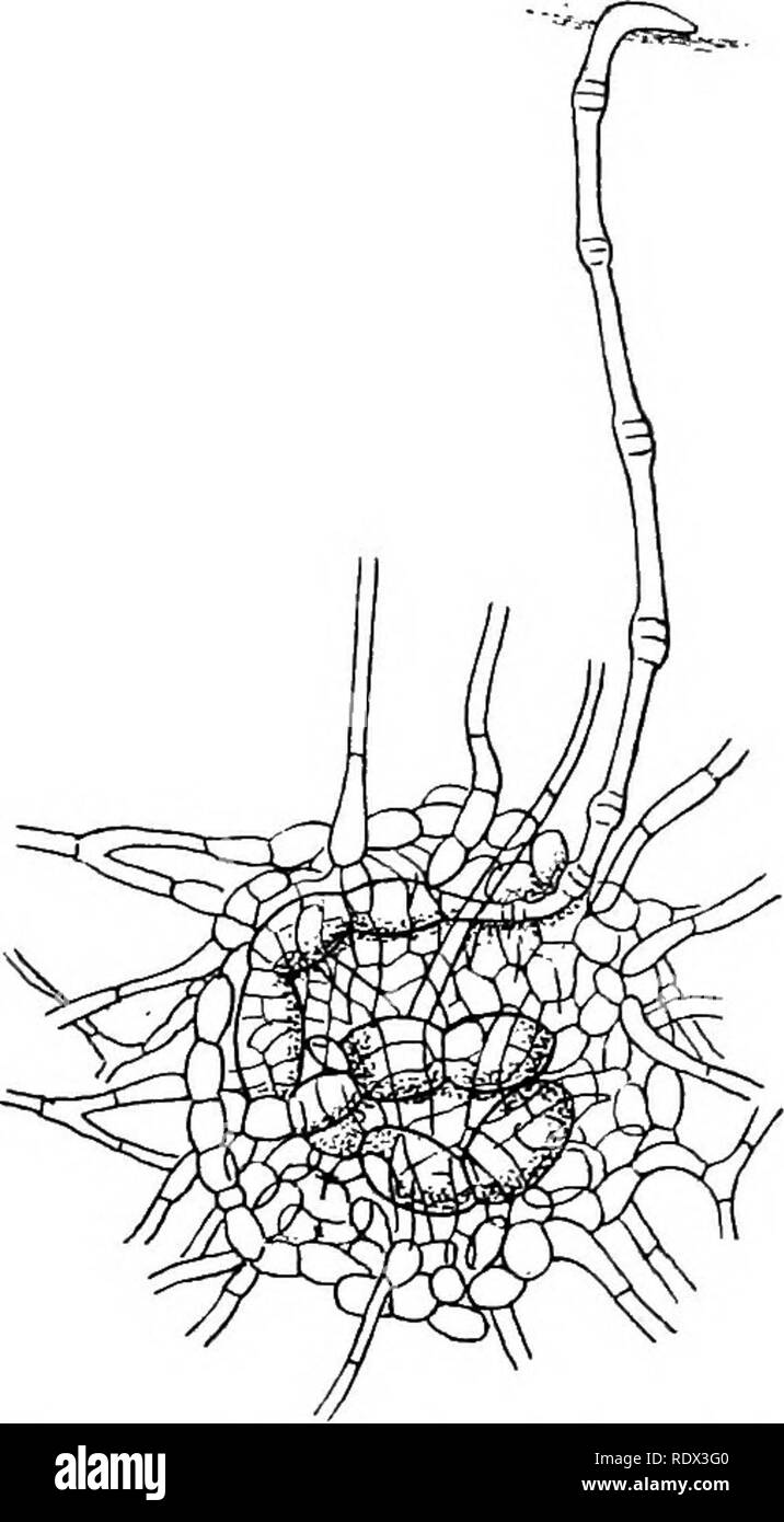 Spiral hyphae Black and White Stock Photos & Images Alamy