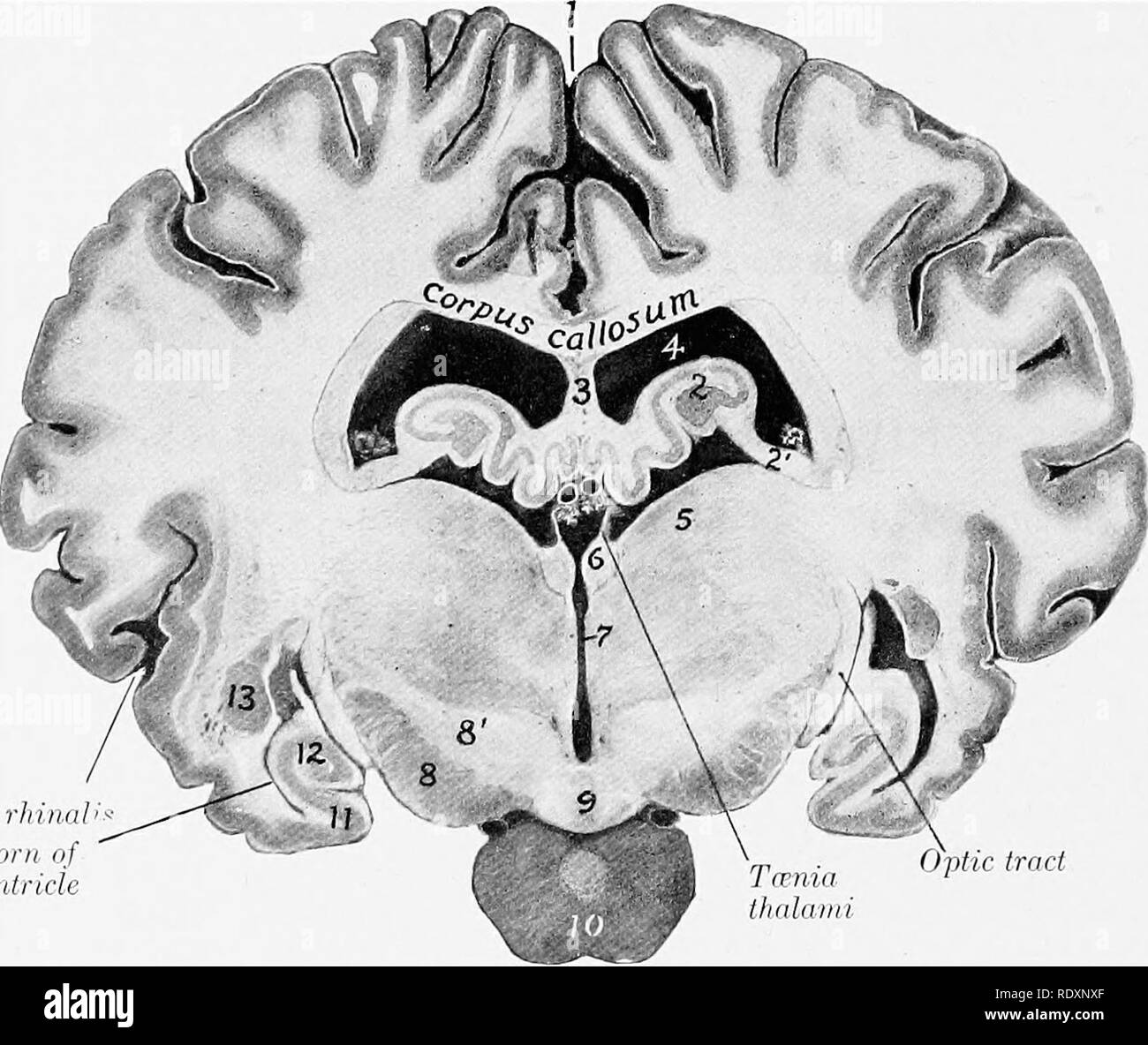 . The anatomy of the domestic animals . Veterinary anatomy. 782 NERVOUS SYSTEM OF THE HORSE base blends in front with the junction of the striae medullares of the thalamus. Immediately under the posterior part of the stalk is a short transverse band of white matter, the posterior commissure of the cerebrimi (Commissura aboralis cerebri). The pineal body is enclosed in a fibrous capsule from which numerous trabeculae pass inward, dividing the organ into spaces occupied by round epitheUal cells of the same origin as the epen- dyma of the ventricle. The mammillary body (Corpus mammillare) is a wh Stock Photo