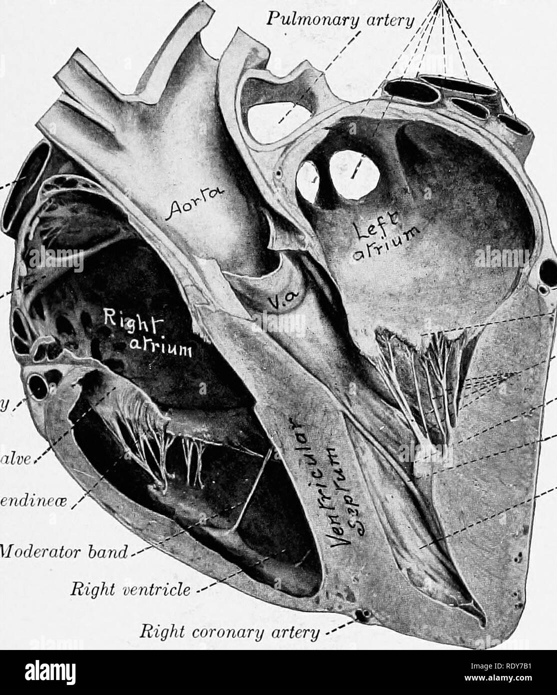 Ventricular septum right ventricle Black and White Stock Photos ...