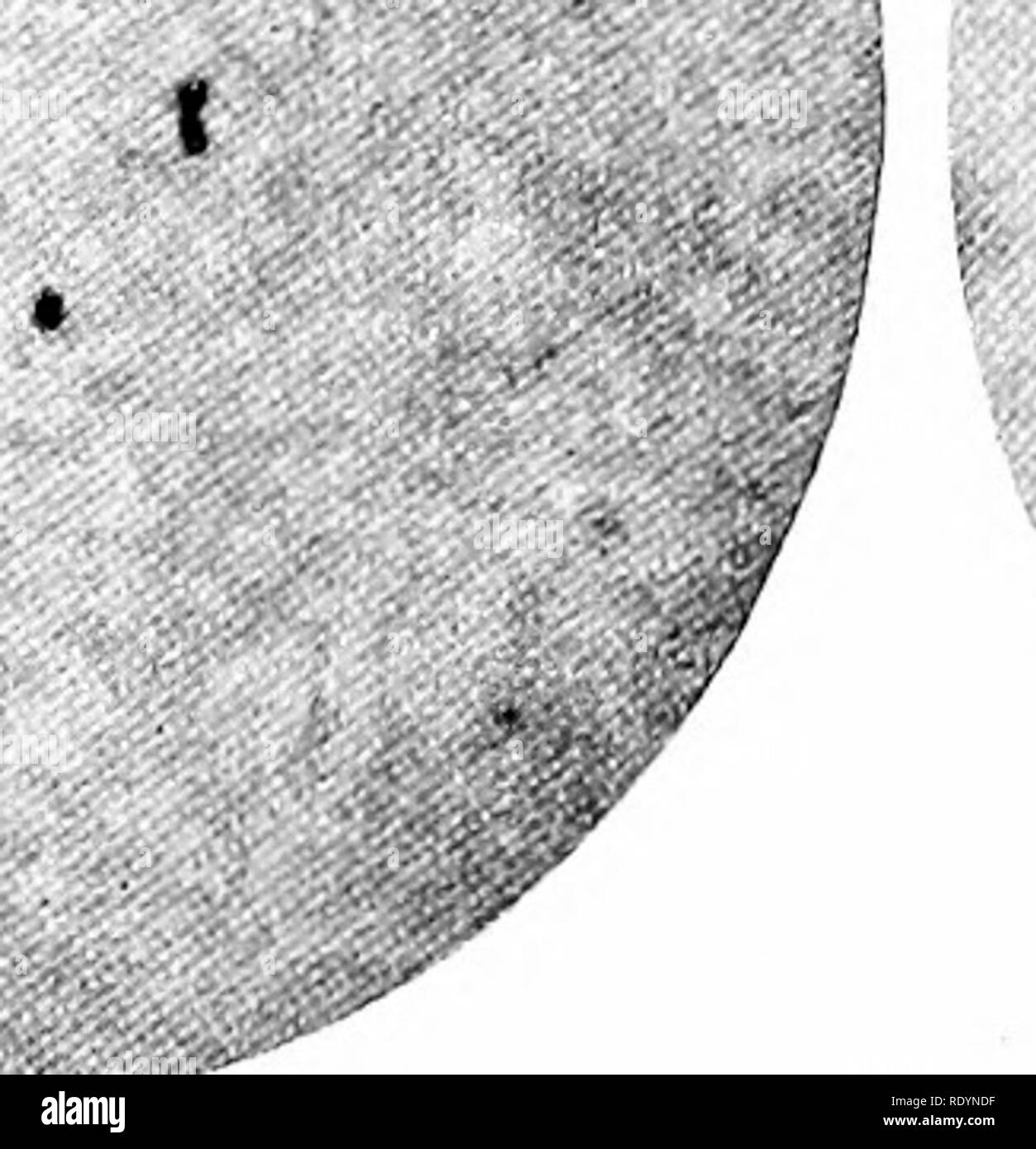 . Milk. Milk. â J Fig. 166, g.âStreptococcus lacticus from litmus milk. (Strain I.) Fig. 166, h.âStreptococcus lacticus from htmus mill;. (Strain II.) Fig. 166, ah.âMicrophotographs of Streptococcus pyogenes and Streptococ- cus lacticus, showing the tendency to diplococcus formation in litmus milk. the bacteria of milk are invaders and not indigenous, and it is therefore reasonable to assume that lactic acid bacteria are also derived from outside sources. They can be identified easily with. Please note that these images are extracted from scanned page images that may have been digitally enhan Stock Photo
