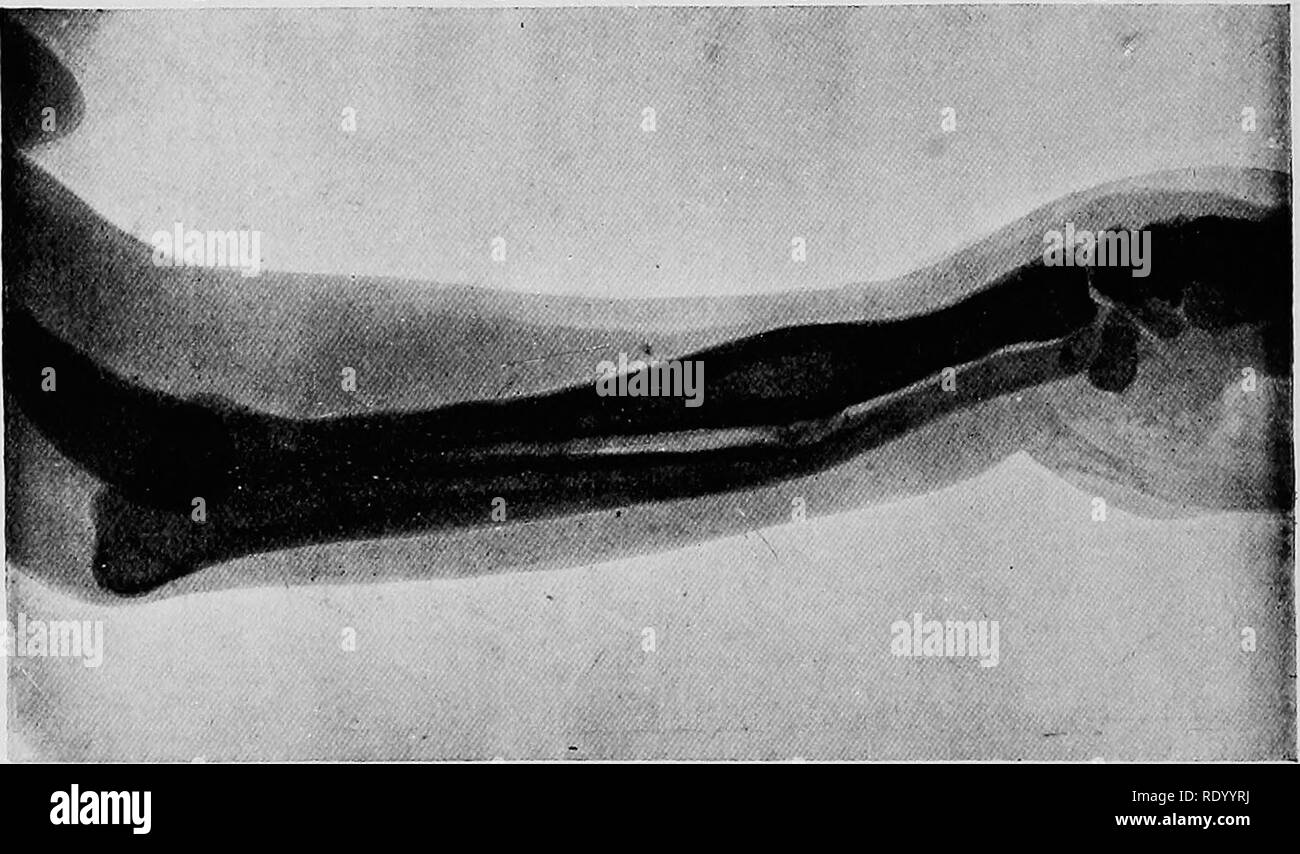 Fractured cat hi-res stock photography and images - Alamy