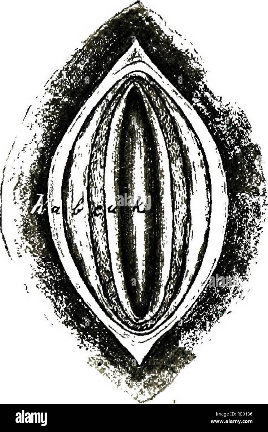 . Surgical and obstetrical operations, for veterinary students and practitioners. Veterinary surgery. 92 URETHROTOMY. LITtlOTOMY. of the neck of the bladder with the lithotome can be under- taken as a last resort. Introduce the instrument closed into the bladder, it is then opened and the neck of the bladder divided upward and laterally as the instrument is withdrawn. In order to prevent injury to the rectum it should be emptied before the operation is undertaken. After the removal of the stone, push the catheter again over the ischial arch and unite the lips of the wound in the urethral mucou Stock Photo