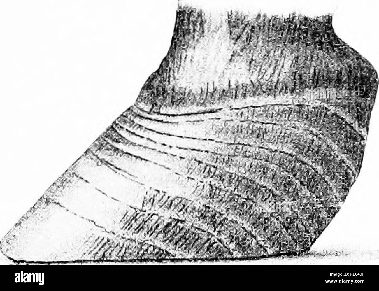 . Veterinary studies for agricultural students. Veterinary medicine. LAMINITIS OR POUNDER. 185 is followed by an exudate which may be either slight or consider- able in amount and more or less persistent. In persistent cases, with considerable exudate, the toe of the os pedis (third phalynx) is gradually pressed downward against the sole. The sole may gradually become convex and the horse becomes permanently un- sound. Termination.—Laminitis may terminate in recovers' and pnu tical restoration of the affected parts, or there may remain a con- vex sole and a chronic soreness with a tendency for Stock Photo
