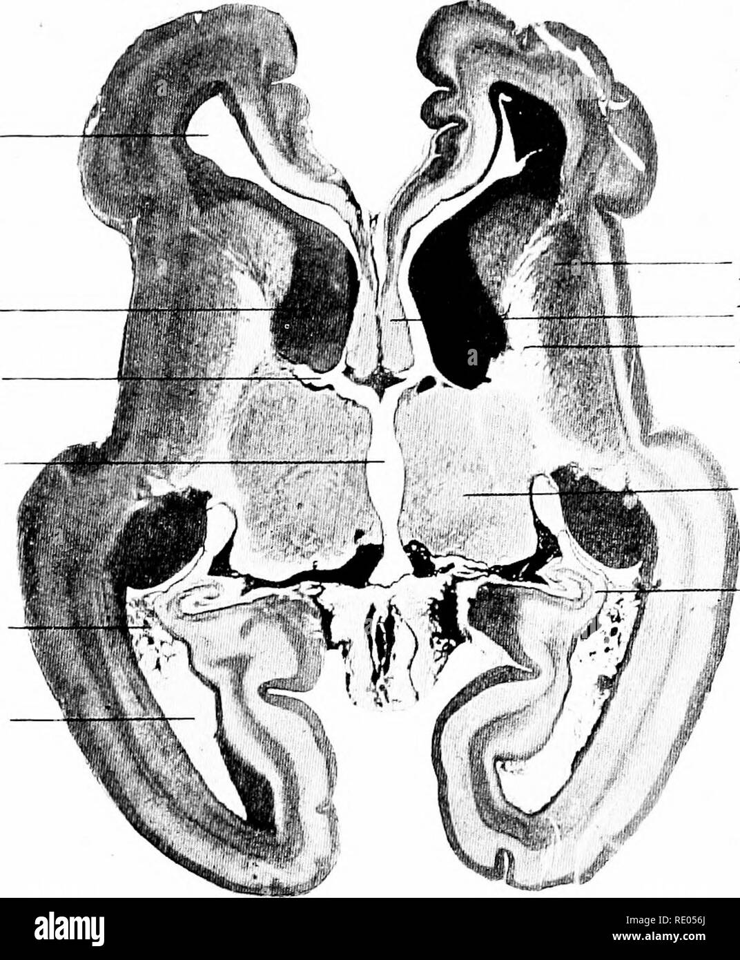 . A laboratory manual and text-book of embryology. Embryology. THE BEAIN 343 thalamus of the diencephalon and in development is closely connected with it, although the thalamus forms always a separate structure. The corpus striatum elongates as the cerebral hemisphere lengthens, its caudal portion curving around to the tip of the inferior horn of the lateral ventricle and forming the slender tail of the caudate nucleus (Fig. 331). The thickening of the corpus striatum is due to the active proliferation of cells in the ependymal layer which form a prominent mass of mantle layer cells. Nerve lib Stock Photo