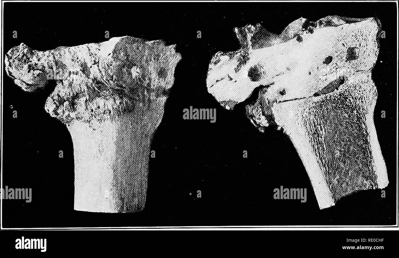 . The spavin group of lameness. Spavin; Horses. o Fig, III. — Longitudinal Section of humerus, shown in Fig. 1). A. Approximately normal articular cartilage. B. Darkened area in bone, due to intense inflammalion, corresponding to the dark areas in Fig. II. C. C. Erosions at margin of articular cartilage.. Fig. TV. — Spavin. Section through the lower tarsal row and metatarsus showing condensing ostitis, with marked osteo-sclerosis in tarsal bones.. Please note that these images are extracted from scanned page images that may have been digitally enhanced for readability - coloration and appearan Stock Photo