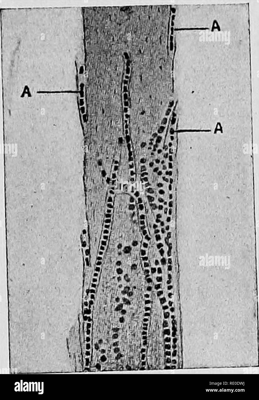 . A text-book upon the pathogenic Bacteria and Protozoa for students of medicine and physicians. Bacteriology; Pathogenic bacteria; Protozoa. Cultivation 799 Morphology.âThe trichophyton parasites form delicate mycelia composed of somewhat slender septate hypha. They can best be observed by extracting one of the hairs, including its root, from the diseased area, or if the affection be upon a hairless part of the body, by scraping off some of the epiderm, and mounting the material between a slide and cover in a drop of caustic potash solution (20 per cent.). Under these circumstances the spores Stock Photo