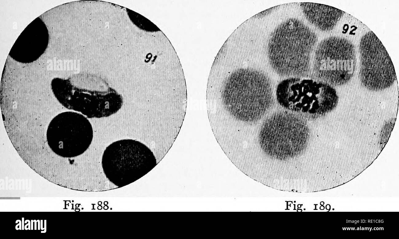 . A text-book upon the pathogenic Bacteria and Protozoa for students of medicine and physicians. Bacteriology; Pathogenic bacteria; Protozoa. The Human Malarial Parasites 509 there are no regularly occurring paroxysms. The duration of the asexual cycle is from twenty-four to forty-eight hours. The gametocytes are striking and characteristic oviod and cres- centic bodies^—crescents—1}4 times the diameter of a red blood- corpuscle in length, and about half the diameter of the corpuscle ©O £' ITo Fig. 1^7.—Parasite of estivo-autumnal fever: a, b, c, Ring-like and cross- like hyaline forms; d, e,  Stock Photo