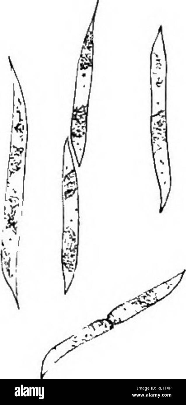 https://c8.alamy.com/comp/RE1FXP/la-biologie-des-plantes-plant-ecology-fis-9-ankistrodesmus-nivalis-raphidium-cellules-en-vole-de-multiplication-gross-eoo-hoo-fois-neige-du-valais-dess-de-r-c-cette-espece-est-tres-differente-du-raphidium-fireti-qui-en-1910-formait-au-glacier-dargentieres-une-neige-verte-caracteris-tique-qui-ma-ete-communiquee-par-monancien-elve-mlvlret-et-dans-laquelle-jai-reconnu-une-espece-nouvelle-fig-10-et-j-elle-tait-si-abondante-dans-cette-station-que-les-chlamydonumas-rouges-et-les-scoliella-jaunes-presents-narrivaient-pas-k-teindre-la-couleur-verte-du-raphuyu-RE1FXP.jpg