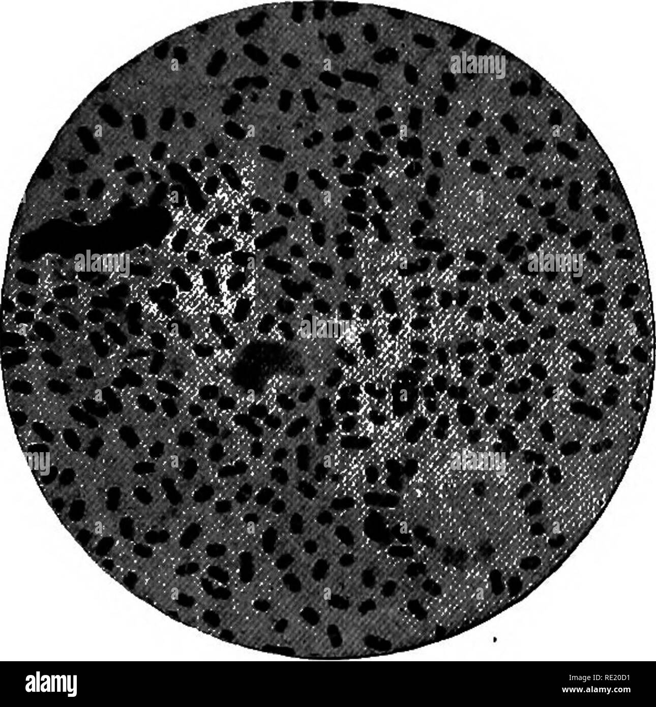 Septicemic plague hi-res stock photography and images - Alamy