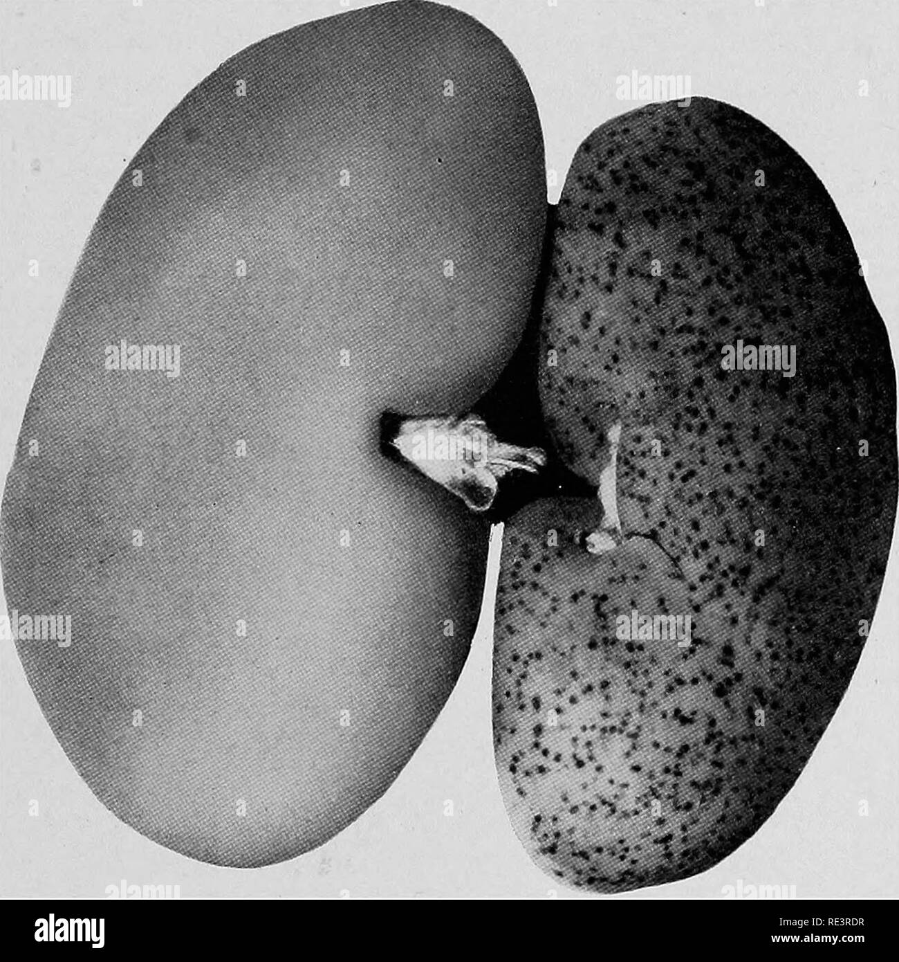 Normal kidney Black and White Stock Photos & Images Alamy