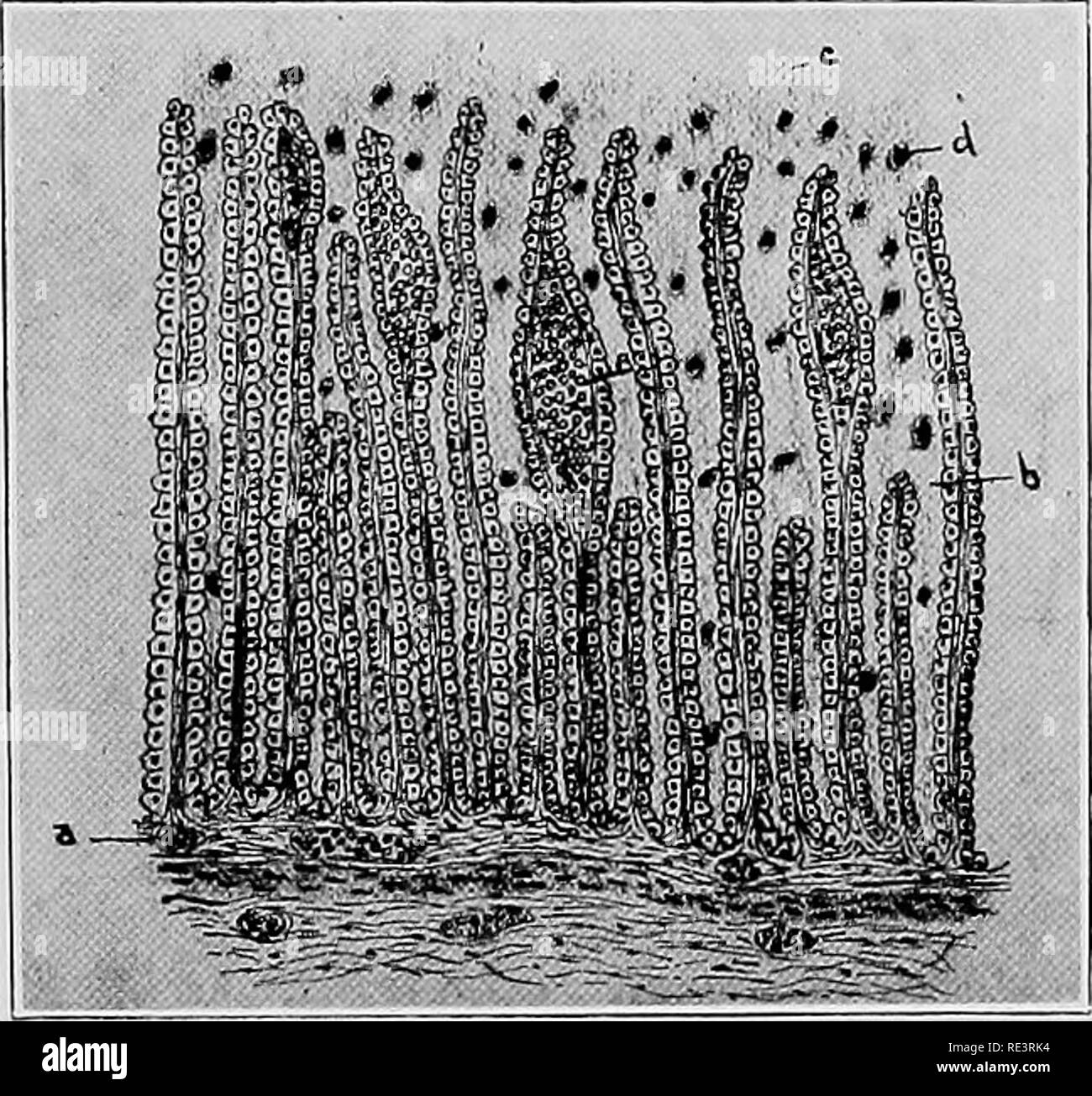 Gastric feeding system Black and White Stock Photos & Images - Alamy