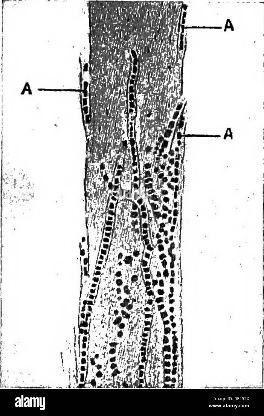 . A text-book upon the pathogenic Bacteria and Protozoa for students of medicine and physicians. Bacteriology; Pathogenic bacteria; Protozoa. Cultivation 753 Morphology.—The trichophyton parasites form deUcate mycelia composed of somewhat slender septate hypha. They can best be observed by extracting one of the hairs, including its root, from the diseased area, or if the affection be upon a hairless part of the body, by scraping off some of the epiderm, and mounting the material between a slide and cover in a drop of caustic potash solution (20 per cent.). Under these circumstances the spores  Stock Photo