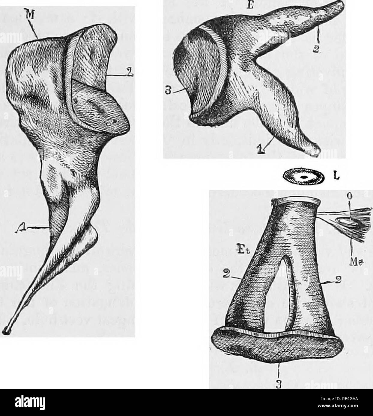 Artwork Of Prosthetic Stapes In Middle Ear Photograph by John