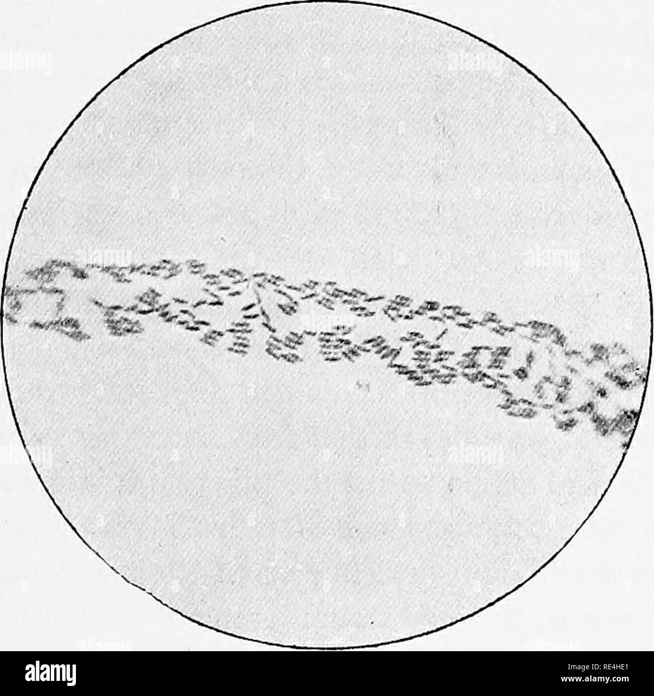 . Micro-organisms and disease. An introduction to the study of specific micro-organisms. Microorganisms. VI] GENERAL CHARACTERS OF BACTERIA 93 symptomatic anthrax, bacillus of tetanus ; asparagin and sodium sail in the case of phosphorescent bacteria (Bey- rinck), milk sugar in the case of bacterium lactis, • The nature of the nutritive medium has in many cases an important effect not only on the morphology but also on the physiological action of bacteria in general, and of pathogenic. Fig. 17.—Impression of a very young Growth of Bacillus Radicicola. bacteria especially. Thus, for instance, t Stock Photo