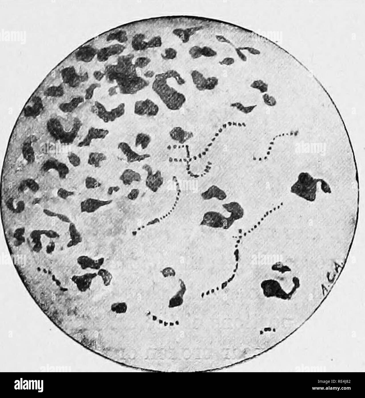 Billroth streptococcus hires stock photography and images Alamy