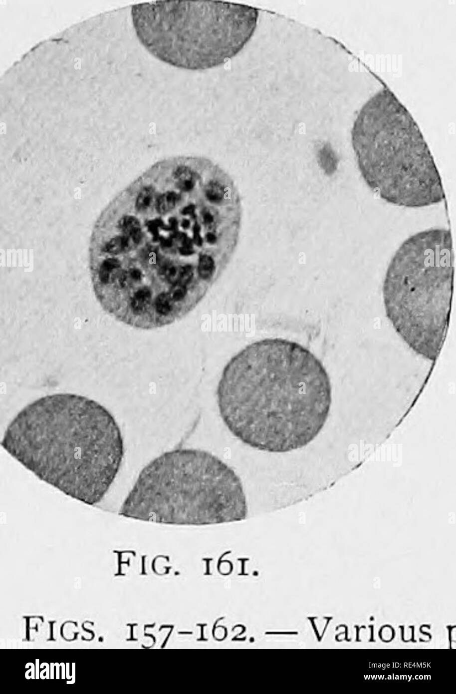 . Manual of bacteriology. Bacteriology.  i^' Fig. 158. / Fig. 159. Fig. 160.. *-• ••V •  ^. Fig. 162. -Various phases of the benign tertian parasite. Fig, 157. Several young ring-shaped amccbnlae within the red corpuscles, one of the latter en- larged and showing a dotted appearance. Fig. 158. A larger amosbula containing pigment granules. Fig. 159. Two large ama:bulas, exemplifying the great variation in form. Fig. 160. Large amcebulae assuming the spherical form andshowing isolated fragments of chromatin — preparatory to sporulation. Fig. 161. Sporocyte, which has produced eighteen spores, Stock Photo