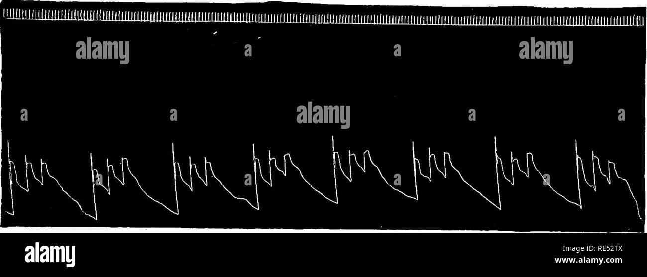 . Special pathology and therapeutics of the diseases of domestic animals. Veterinary medicine. Pathogenesis, Symptoms. 1059 sequence tte arterial pulse omits in spite of the additional contraction of the heart. Symptoms. In omission of the ventricular systole a pause corresponding to one heart beat can often be observed after every 2 to 5 heart beats. The intermissions are, however, often. Fig. 183. Intermittent heart action in the horse. Sphygmograph of the abdominal aorta. &quot;Intermission of two successive pulse beats (Time indicated in 0.2&quot;). much  less frequent, only after every 10 Stock Photo