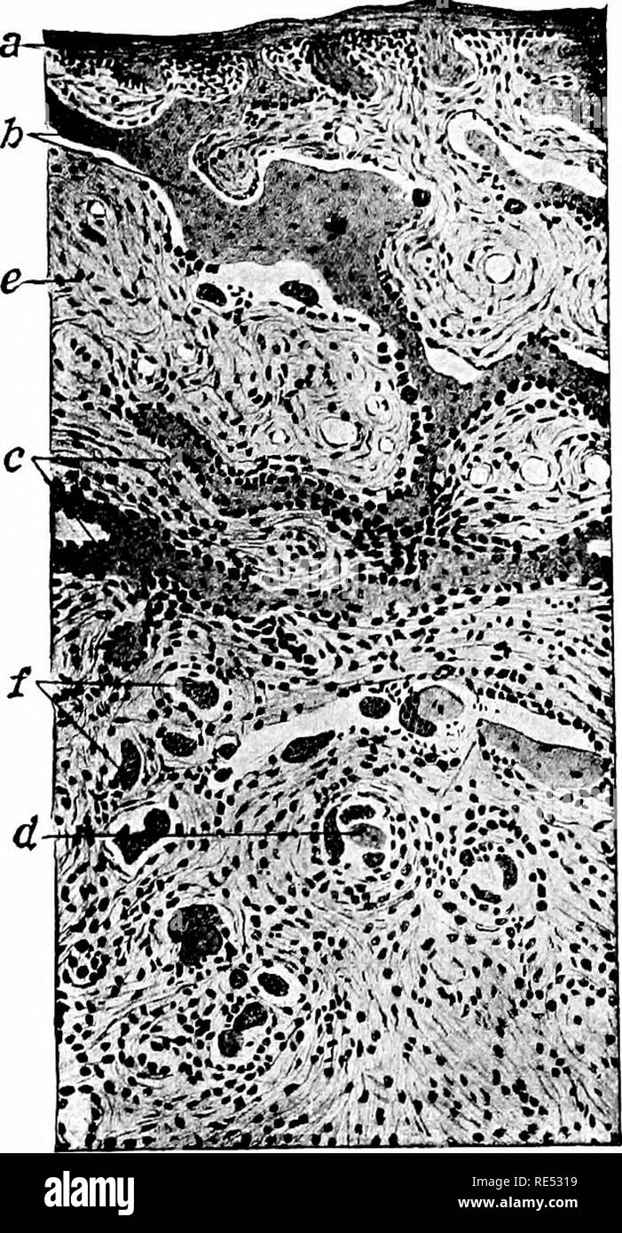Special pathology and therapeutics of the diseases of domestic animals. Veterinary medicine. 956 Osteomalacia, marrow much reddened and studded witli punctiform liemor- rhages; if cachexia already exists the bone marrow is Special pathology and therapeutics of the diseases of domestic animals. Veterinary medicine. 956 Osteomalacia, marrow much reddened and studded witli punctiform liemor- rhages; if cachexia already exists the bone marrow is