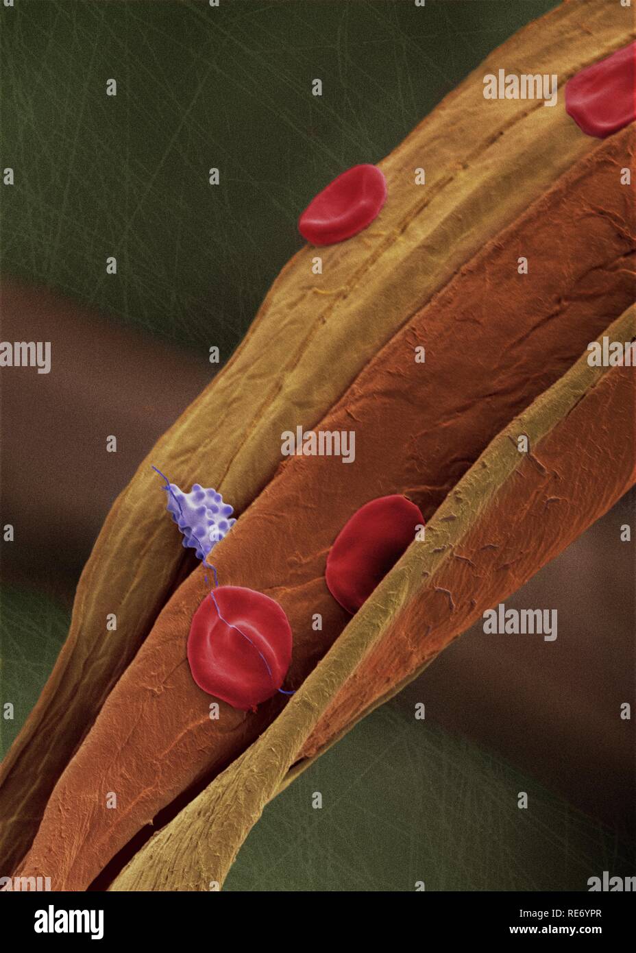 Células sanguíneas humanas sobre una fibra. Fotografía microscopio electrónico de barrido (MEB o SEM). Células sanguíneas humanas sobre una fibra de algodón. Se muestran dos tipos celulares: glóbulos rojos (eritrocitos) y glóbulos blancos (leucocitos) coloreados en violeta. La sangre está compuesta de diferentes tipos celulares. Aquí se muestran los eritrocitos en color rojo. Éstos carecen de núcleo celular y están destinados al transporte de gases. Los eritrocitos son ricos en hemoglobina, una proteína rica en hierro con afinidad para pequeñas moléculas tales como el oxígeno y dióxido de carb Stock Photo