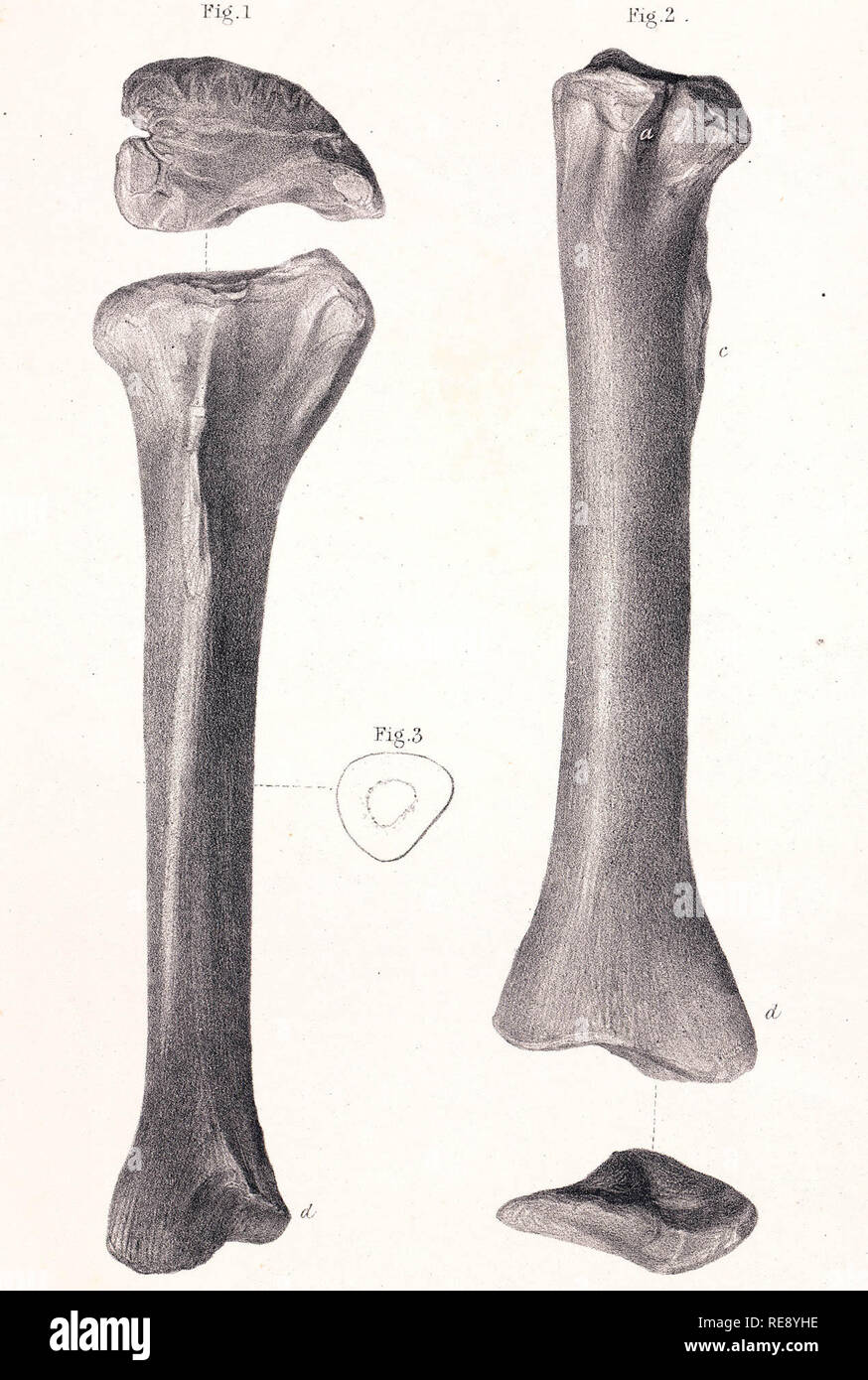 Referred tibia, lateral view (left), posterior view (right). Lithograph drawn by J. Erxleben in the 19th century Stock Photo