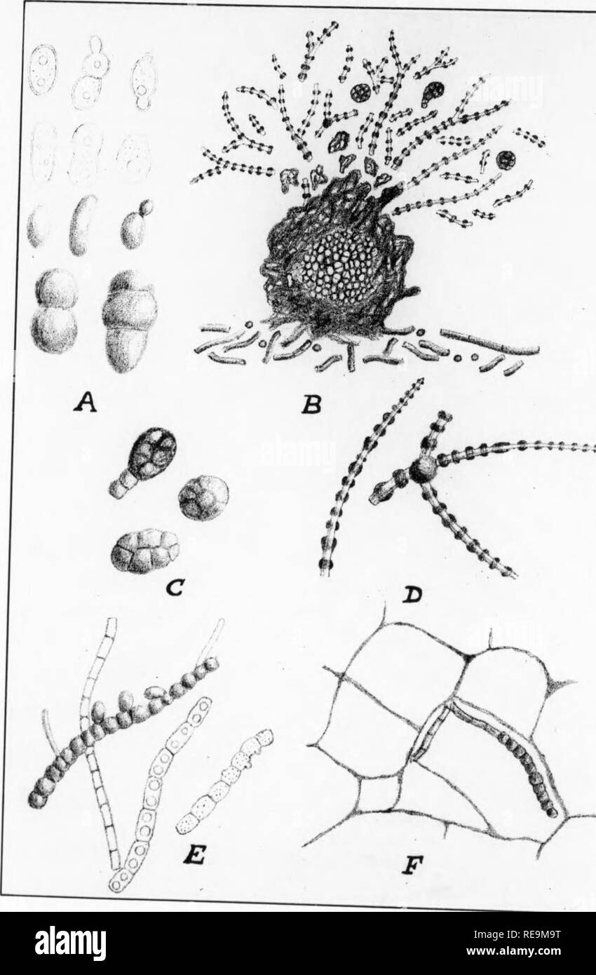 . Contributions from the Botanical Laboratory and the Morris Arboretum of the University of Pennsylvania, vol. 14. Botany; Botany. 12 'if f&gt; &gt;e7 C. Fig. 4. T)rmalium pullnlans {i^ -tr- at,. ^ left i, the ty,,i,-.nl f„rm. ' IS. See io, t 'nLl, ^ ,!?&quot;' f &quot;'!'&quot;»»;.&quot;'« spore in tl.e upper in li.|„i,l ,.„ltn,e. J). X,„lose Inpl,,,.. E Tvne', , f 1 • *&quot;&quot;»''&quot;&quot;'&quot;&quot;K &gt;&gt;o';,&quot;r; ean;e&quot;rid;)'r'&quot;'^&quot;&quot;' *&quot; &quot;&quot; Ai M it I 13 were satisfactorily demonstrated in unstained sections. No hypliae were observed in  Stock Photo