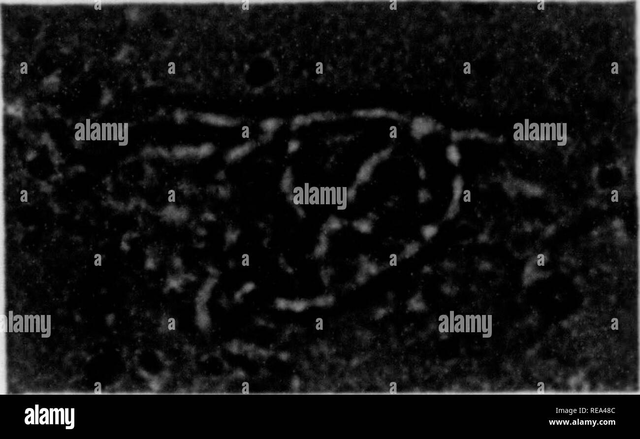 Babydatierung Scan-Lefen