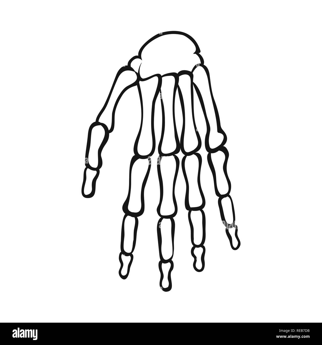 wrist,hand,calcium,structure,arm,carpus,health,xray,finger,injury,bone ...