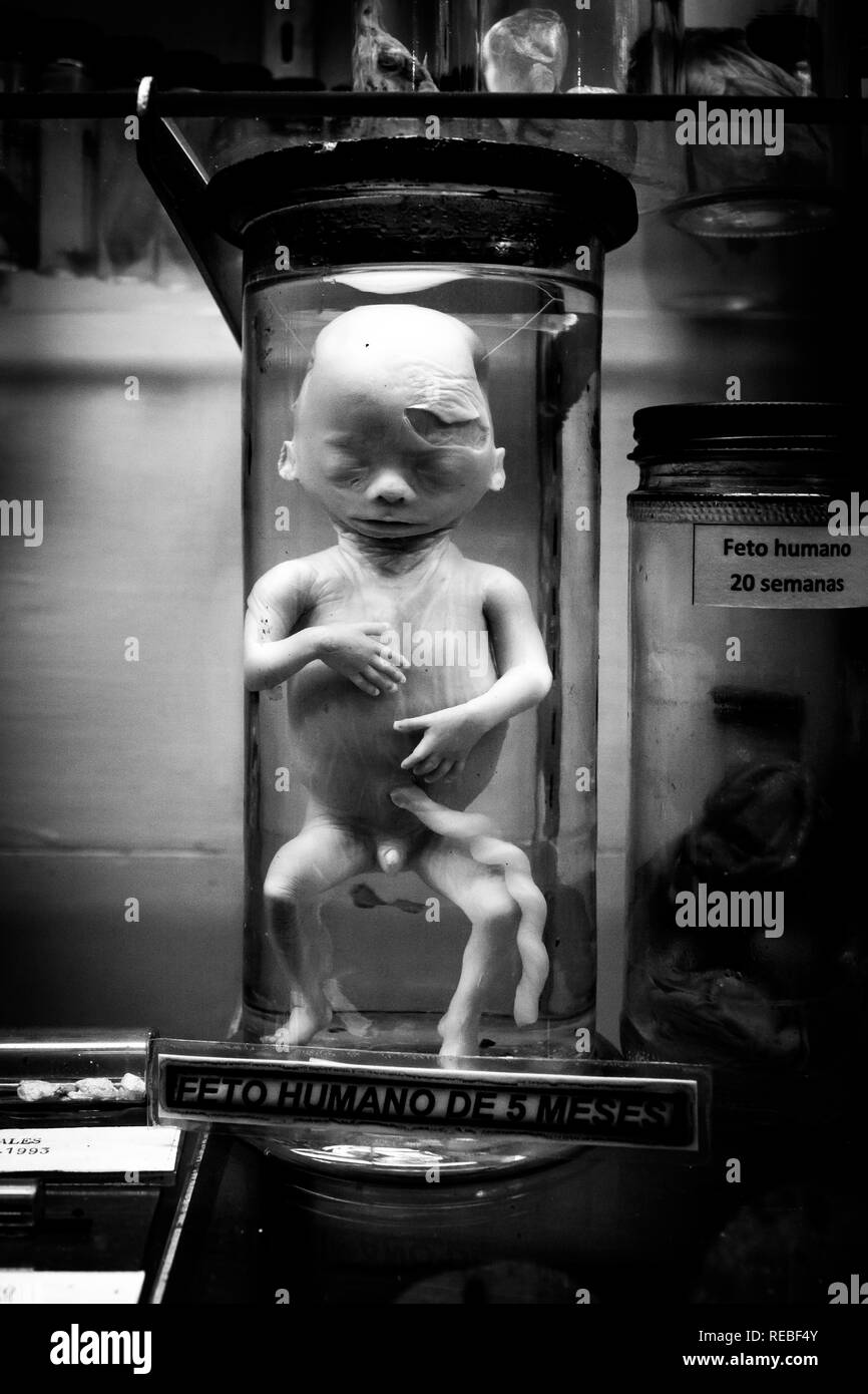 A black and white photo of a 5 months old human fetus. The specimen is a part of scientific exhibition at La Salle Natural History Museum in San Jose. Stock Photo