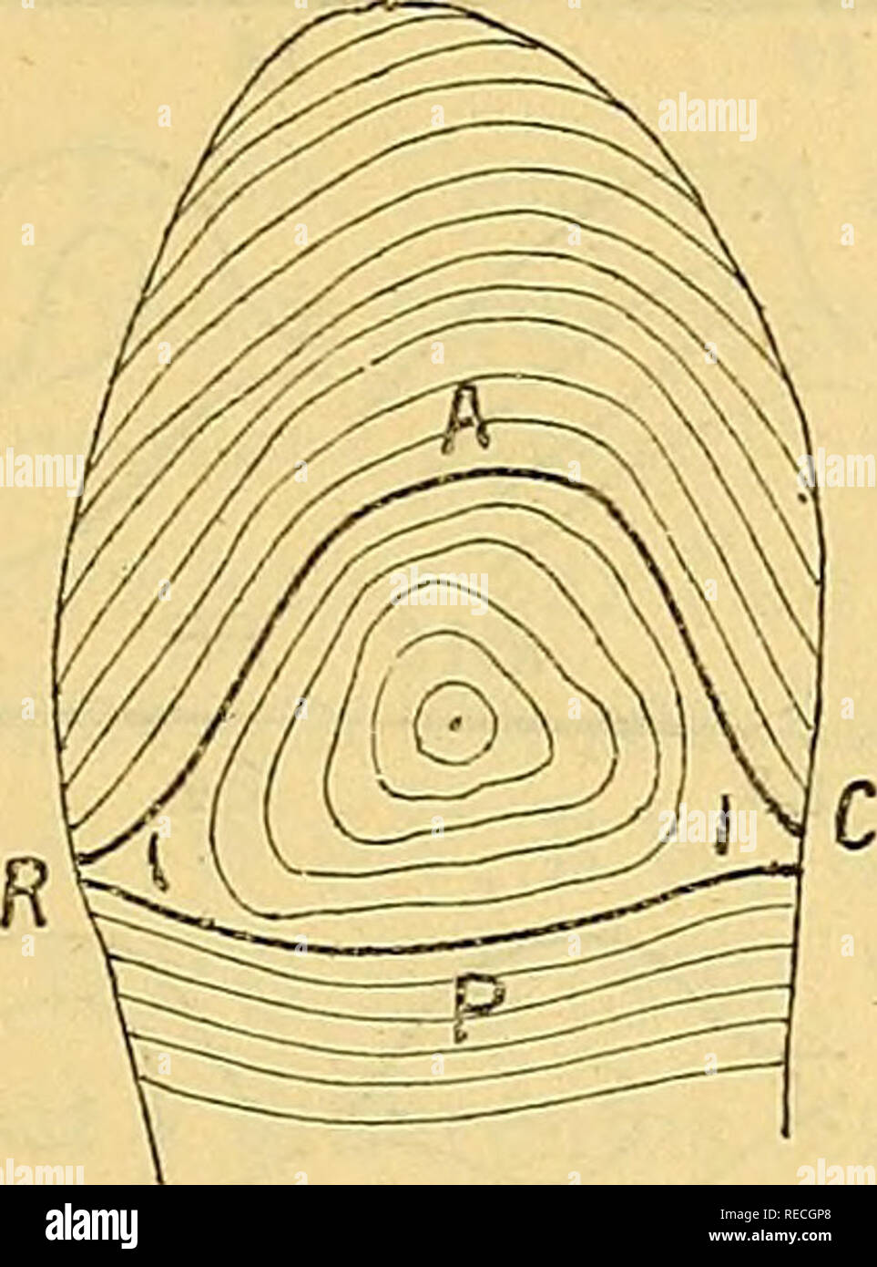 . Comptes rendus des sÃ©ances de la SociÃ©tÃ© de biologie et de ses filiales. Biology. SÃANCE DU 27 JUIN 499 dÃ©formation ni anomalie, et on les retrouve entre les systÃ¨mes des lignes courbes et longitudinales de l'Ã©minence hypolhÃ©nar. Dans les cas oÃ¹ l'espace est symÃ©trique, il est limitÃ© latÃ©ralement par deux angles qui rÃ©pondent au point de rencontre des lignes elliptiques et des lignes transversales (fig. 1). C'est sur l'existence de ces deux angles que repose toute la classification de M. Galton, que je vais suivre avec quelques altÃ©rations ne portant guÃ¨re que sur des dÃ©tails. Stock Photo