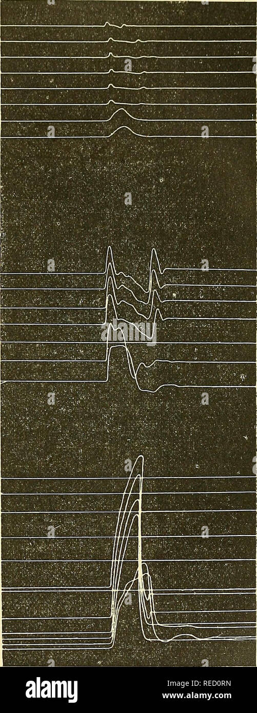 barrière extensible sur pied