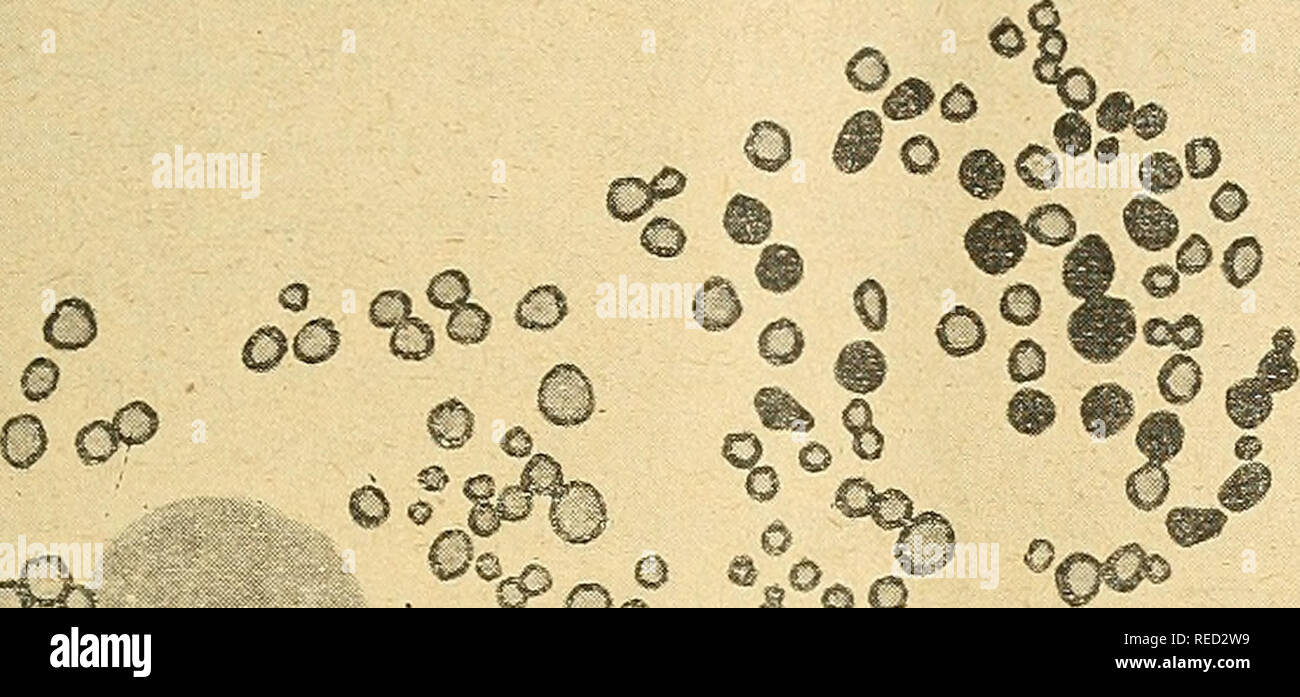 . Comptes rendus des sÃ©ances de la SociÃ©tÃ© de biologie et de ses filiales. Biology. (57) SÃANCE DL 2S NOVEMBRE 1031 surcoloration de la pÃ©riphÃ©rie de la iiiitochondrie par le violet ? La preuve de la rÃ©alitÃ© dexes figures nous a Ã©tÃ© fournie par l'exa- men de piÃ¨ces identiques, c'est-Ã -dire fixÃ©es par le mÃ©lange osmi- que de Meves, mais non colorÃ©es par le cristallviolet. Sur ces ob- jets, on aperÃ§oit en effet des cercles noir foncÃ© dont le centre trÃ¨s faiblement osmio-rÃ©ducteur prÃ©sente une teinte gris clair. Les. â¢ ^ ^0% m. Oo 'U. Please note that these images are extracte Stock Photo