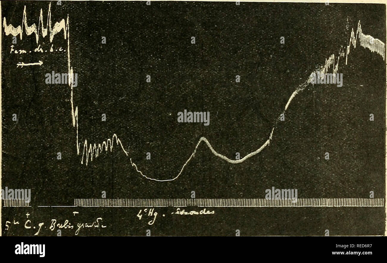 . Comptes rendus des sÃ©ances de la SociÃ©tÃ© de biologie et de ses filiales. Biology. SÃANCE DU 18 NOVEMBRE 445 respiration; pendant rabaissement de la pression artÃ©rielle, il y a une phase de ralentissement du cÅur (i). Les injections ultÃ©rieures ne dÃ©terminent plus l'effet cardio-vasculaire de la premiÃ¨re (immunisation rapide). Outre toutes ces recherches, nous en avons encore fait quelques autres, consacrÃ©es Ã l'Ã©tude sÃ©parÃ©e de l'action des corpora albicantia (corps jaunes rÃ©gresses) de Vache et de Truie et Ã celle du liquide folli- culaire de Vache (gravide ou non gravide) et de Stock Photo