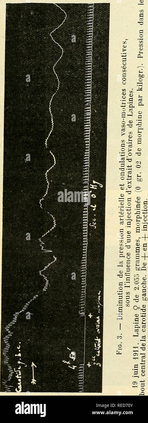 . Comptes rendus des sÃ©ances de la SociÃ©tÃ© de biologie et de ses filiales. Biology. SÃANCE DU 11 NOVEMBRE 411 tissu ovarieu diminue considÃ©rablement l'effet vaso-conslricteur de 1/10 de milligr. d'adrÃ©naline, si elle est faite presque tout de suite aprÃ¨s celle de ce corps, tandis que son propre effet vaso-dilatateur ne subit aucune altÃ©ration (flg.2). Les extraits d'ovaires de Brebis (quatre expÃ©riences) ont Ã©tÃ© sans effet. Les extraits d'ovaires de Jument ont Ã©tÃ© Ã©galement trouvÃ©s inactifs, Ceux d'ovaires de Jument gravide ont manifestÃ© quelque activitÃ© (abaissement de la pres Stock Photo