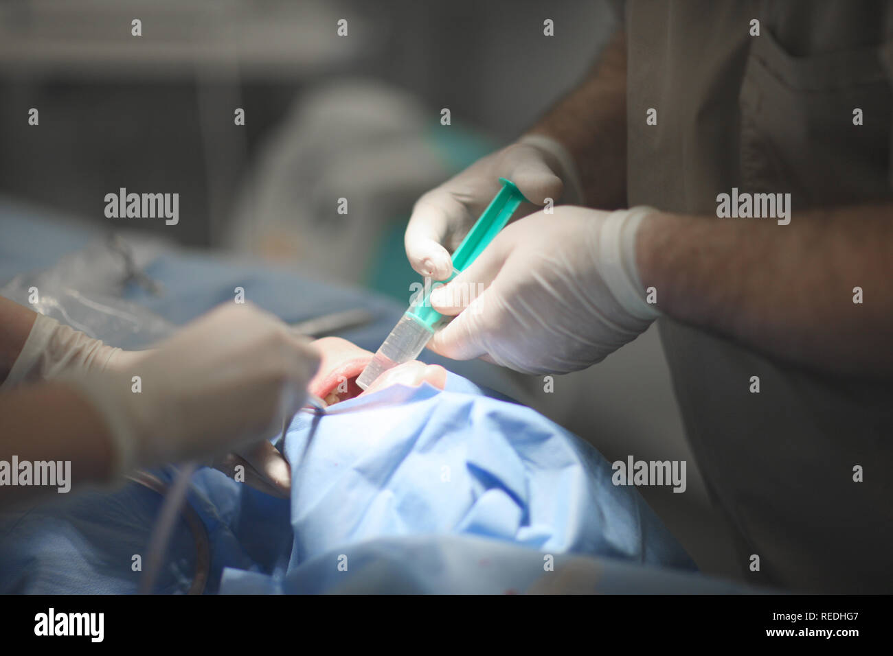 Doctor with assistant perform dental surgery on the jaw of the patient