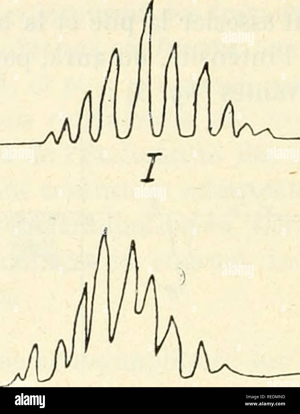 Compte rendu. Science; Science -- Congresses. 308 ÃLECTRICITÃ MÃDICALE  tion, les nerfs et les muscles rÃ©pondent au courant galvanofaradique, pile  et bobine Ã©tant en sÃ©rie, par des contractions plus fortes qu'au