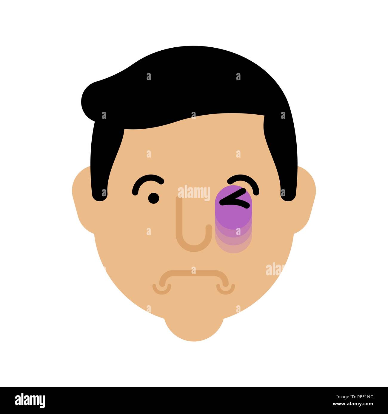 Eye bruise face. Bruise head. Black eye Portrait Stock Vector