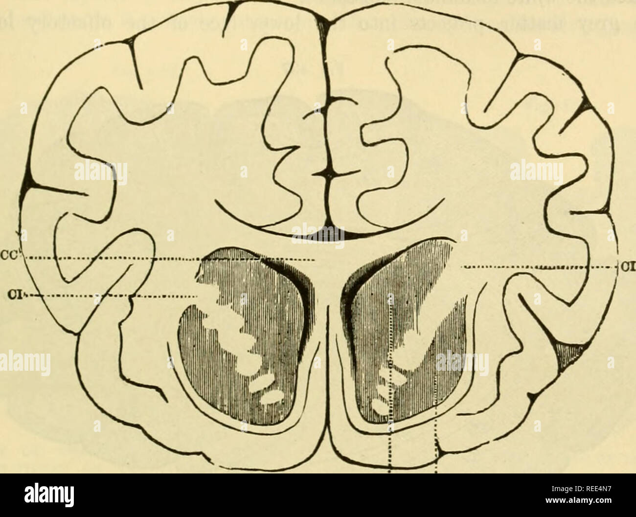 The Comparative Anatomy Of The Domesticated Animals Horses Veterinary Anatomy The Cerebrum 793 Transverse Fissure And Insinuates Itself Between The Thalamus Opticus And The Convolution Of The Cornu Ammonis The Velum