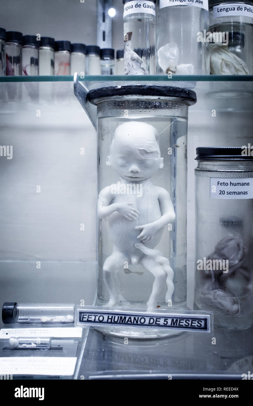 A photo of a 5 months old human fetus. The specimen is a part of scientific exhibition at La Salle Natural History Museum in San Jose, Costa Rica. Stock Photo