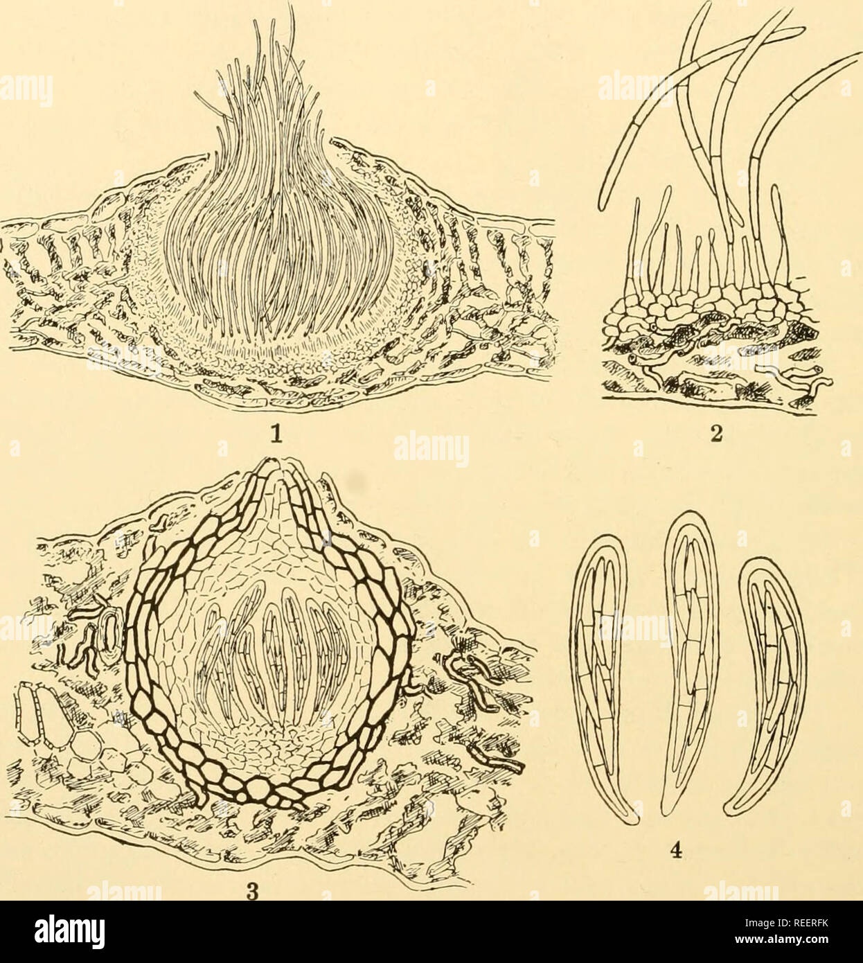 . Comparative morphology of Fungi. Fungi. 268 COMPARATIVE MORPHOLOGY OF FUNGI To Septorisphaerella belong Mycosphaerella Hippocastani (Carlia Hippocastani), a leaf spot of Aesculus Hippocastanum, and M. sentina, a leaf spot of pear. As imperfect forms besides pycnia with multicellular conidia (Septoria aesculicola), Klebahn (1918) found in culture free falcate conidia similar to Septoria conidia which are cut off laterally on hyphae and also pycnia with very small bacilliform microconidia.. Fig. 178.—Mycosphaerella sentina. 1. Pycnial stage. Septoria pyricola. 2. Part of perithecial wall. 3. P Stock Photo
