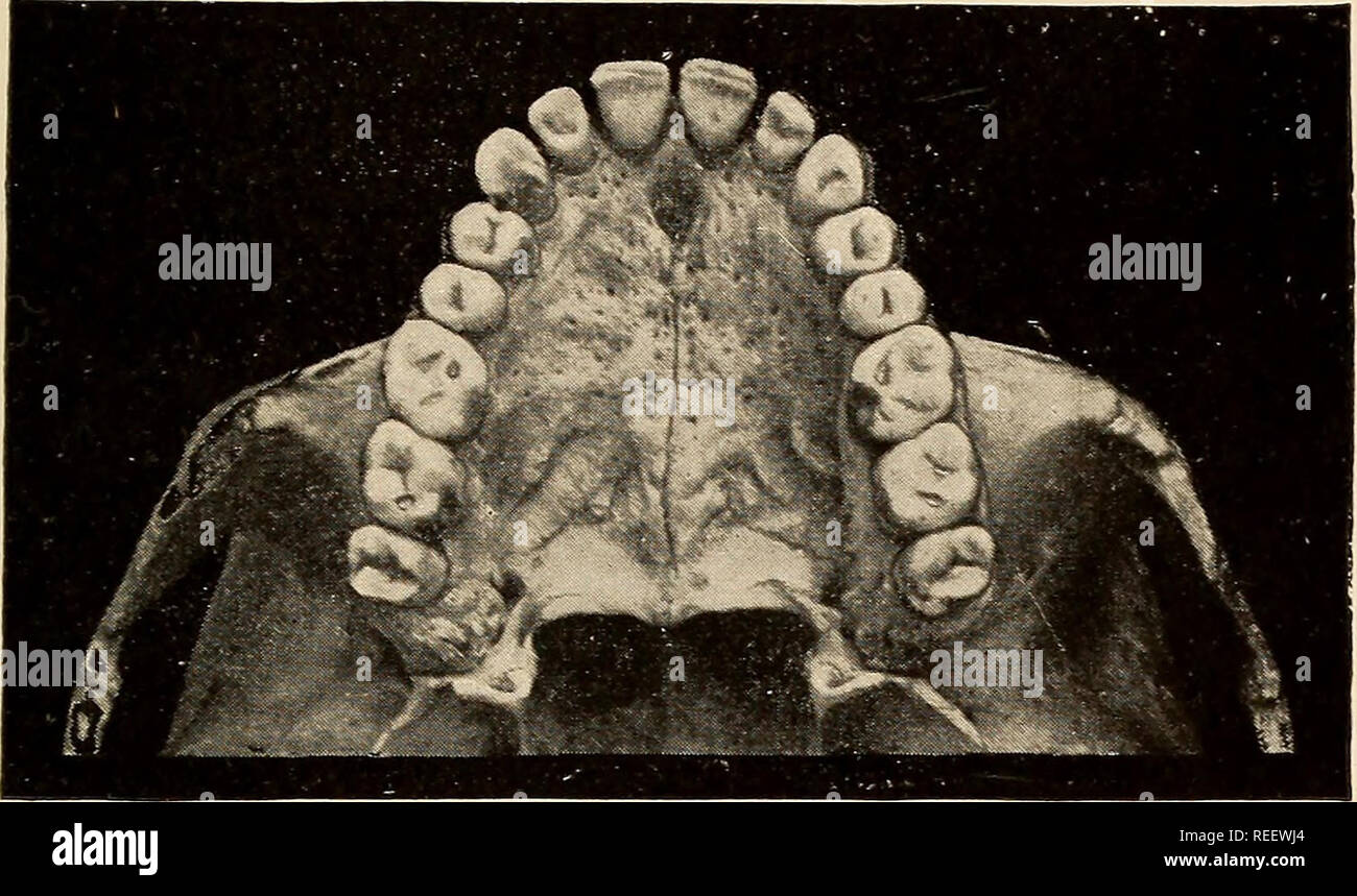 Comparative dental anatomy. Teeth; Dentistry. THE TEETH OF THE HIGHER APES  AND MAN 203 i.e., small-toothed,—as are also the Xanthocroids, but the  latter are more properly mesodonts,—i.e., of intermediate size. The