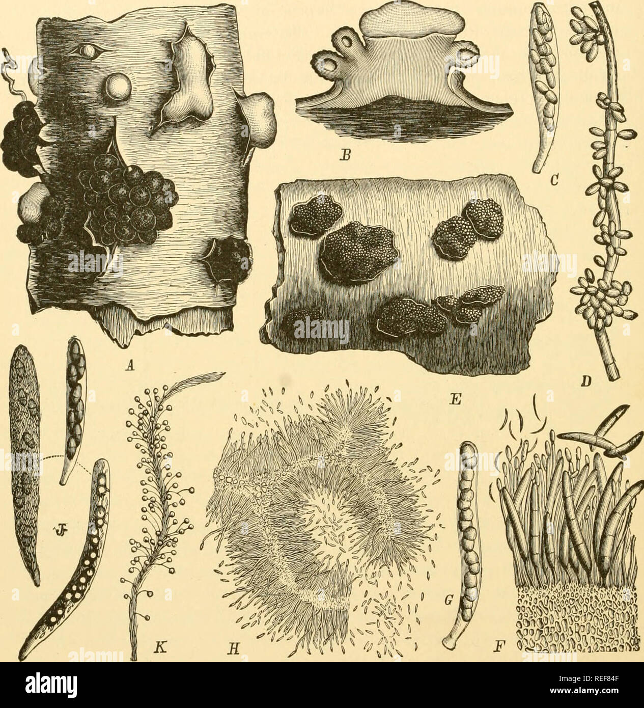 . Comparative morphology of Fungi. Fungi. 234 COMPARATIVE MORPHOLOGY OF FUNGI Gemmae and conidia are known as imperfect forms. The gemmae are mostly hyaline or brownish and occasionally verrucose; they develop (especially in drying cultures) on hyphae, singly or catenulately, and. Fig. 150.—Nectria cinnabarina. A. Conidial stromata (shown light) perithecial stromata (dark) erumpent from bark of host, B. Section through a stroma which is still cutting off conidia at the top while it has formed perithecia on the sides. C. Ascus. D. Hypha with microconidia. Nectria ditissima. E. Perithecial layer Stock Photo