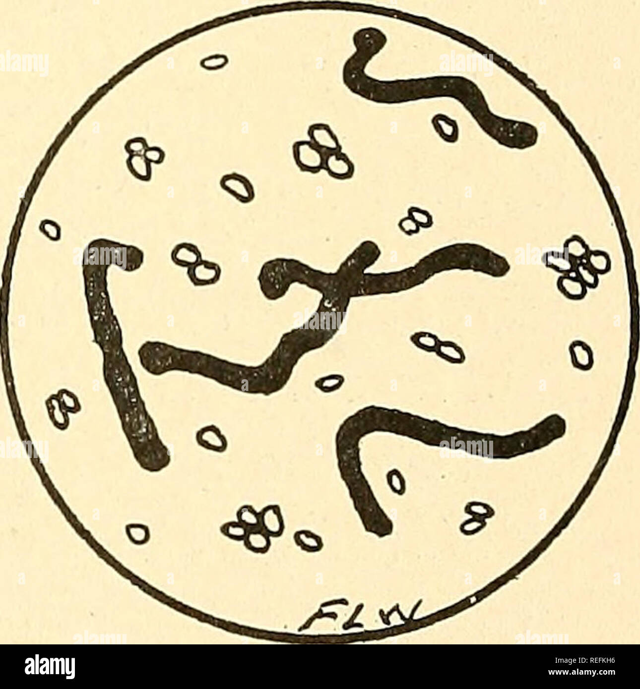 Diseases Caused By Bacteria In Water