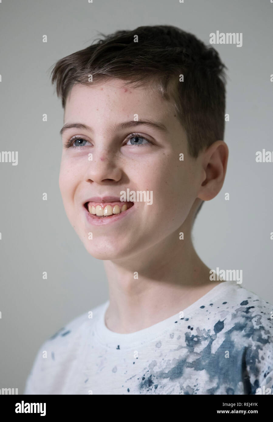 15-year-old Mason Kettley who has a rare brain tumour who will undergo world leading treatment at the NHS's new proton beam therapy centre at The Christie hospital in Manchester. Stock Photo
