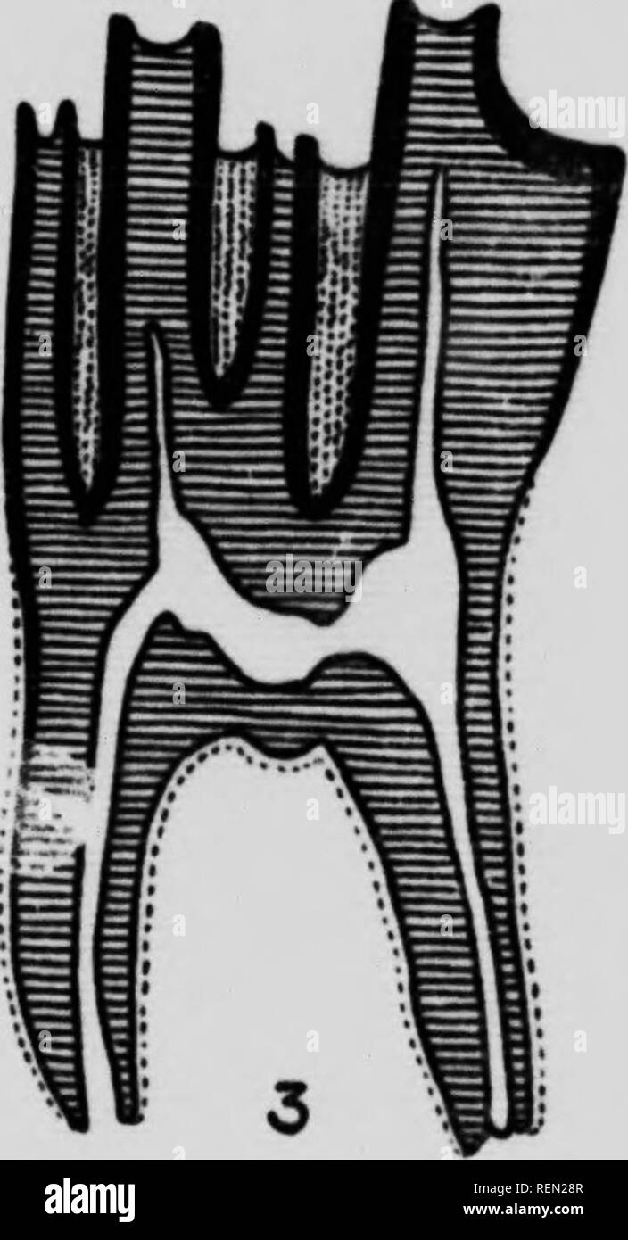 Pulp cavity of tooth Black and White Stock Photos & Images - Alamy
