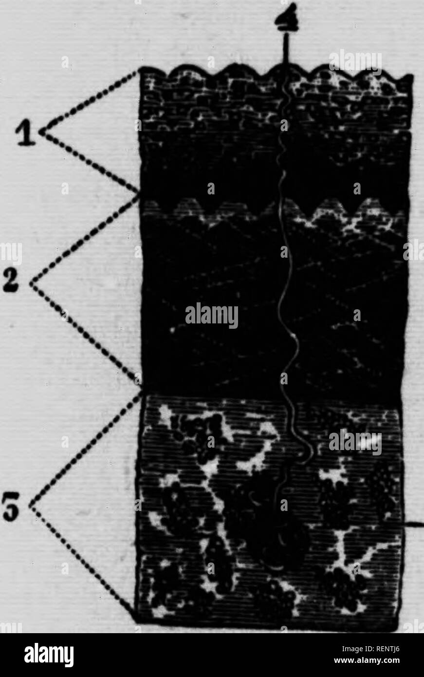 de quoi est morte joséphine baker