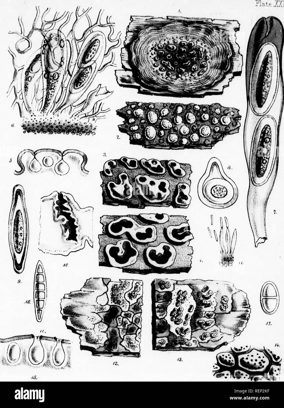 . A popular history of British lichens [microform] : comprising an account of their structure, reproduction, uses, distribution, and classification. Lichens; Lichens. immersed, row neck, thallus.* and â¬t8os, en Endo- in having cent tha- it resem- diflfers in  ostiole, squamu- w black- ) a con- Ostioles Lawers, y. Its !013). gather). 3,1855.. ^â :x7-1dPitfih1ith rii..,eTi', tj. Please note that these images are extracted from scanned page images that may have been digitally enhanced for readability - coloration and appearance of these illustrations may not perfectly resemble the original work Stock Photo